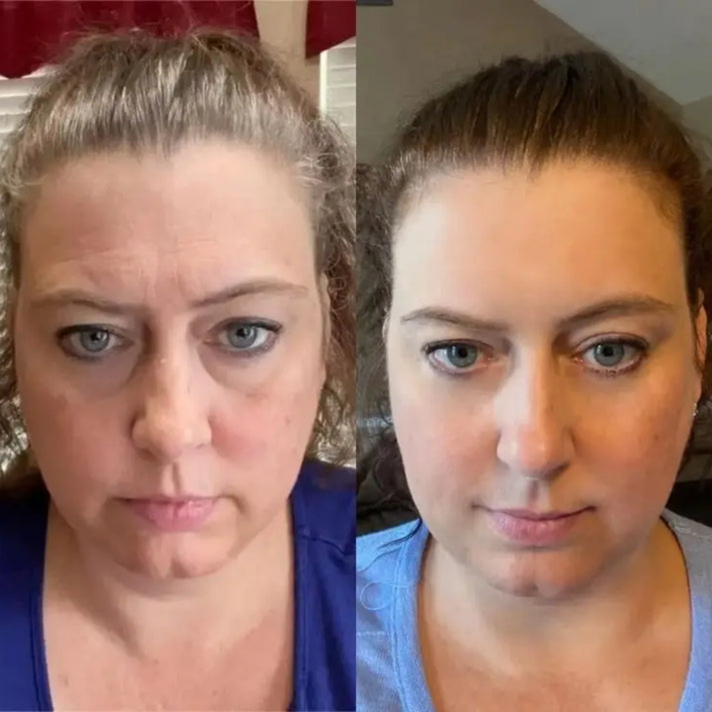 Glorina® Retinal Shot Cream